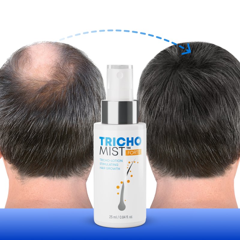 Trichomist Forte – Pomożemy Ci Wygrać Walkę z Trądzikiem